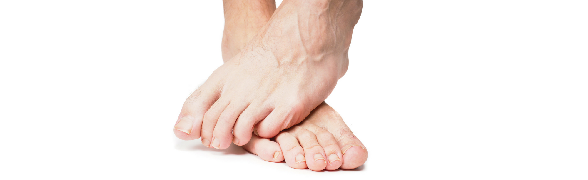 Spasms, Cramps, and Charley Horses…..Oh My!