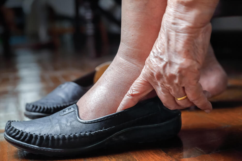 Where to Find Lymphedema Therapy in Havelock, North Carolin Lymphedema Therapy Where to Find Lymphedema Therapy in Havelock, North Carolin