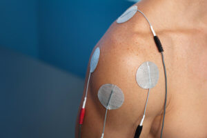 Rotator Cuff Treatment