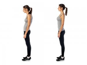 Posture Treatment